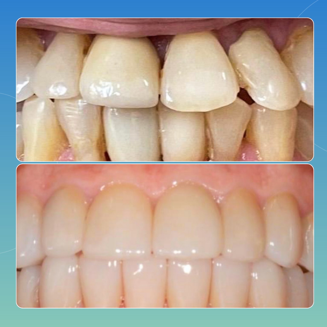 Riabilitazione Completa