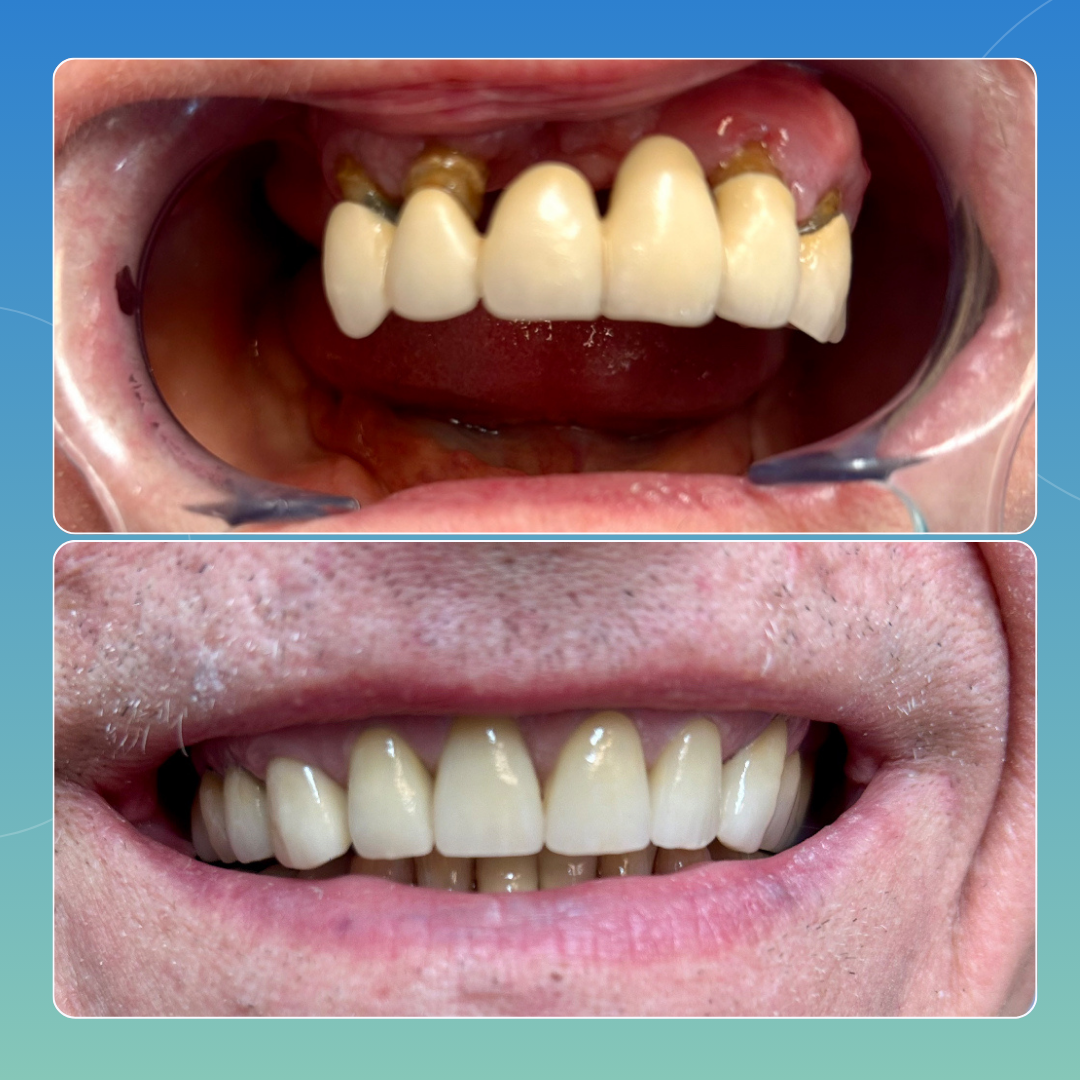 Riabilitazione Completa