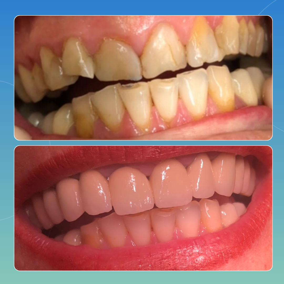 Riabilitazione totale